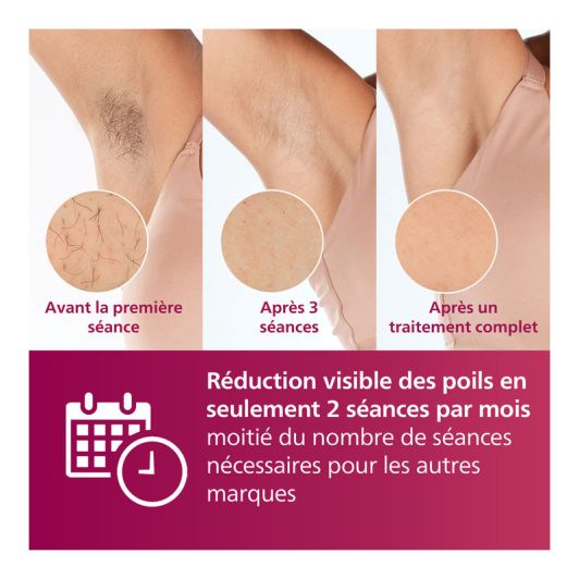 Epilateur à lumière pulsée IPL PHILIPS LUMEA 7000 - BRI921/00